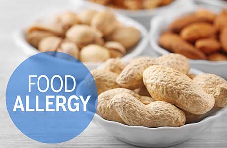Children With Food Allergies Predisposed to Asthma and Rhinitis